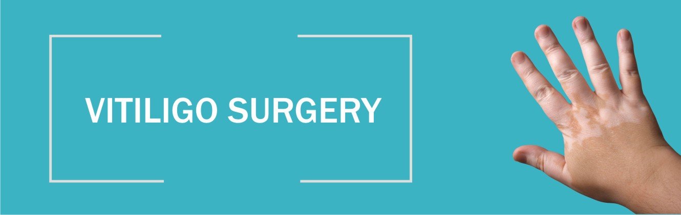 VITILIGO SURGERY