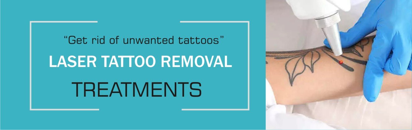 Laser Tattoo Removal – Shri Hari Skin Care